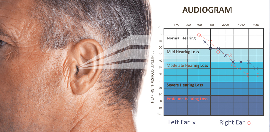 Your audiologist can help set your hearing aid to its best frequency response and volume level.